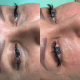 Rewitalizacja skóry pod oczami za pomocą stymulatorów egzosomów kolagenu